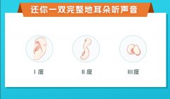 揭秘耳朵畸形手术费用：你的钱包准备好了吗？