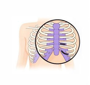 自体肋肋软骨造耳手术是否安全