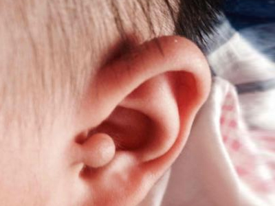面对附耳该怎么办